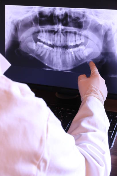 Best Emergency Wisdom Tooth Extraction in Rossville, IN