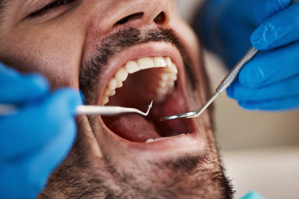 Best Emergency Care for Gum Disease in Rossville, IN