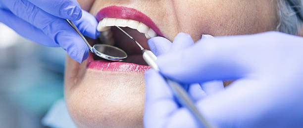 Best Dental Abscess Treatment in Rossville, IN