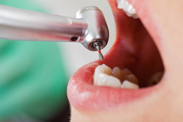 Best Walk-In Emergency Dental Services in Rossville, IN